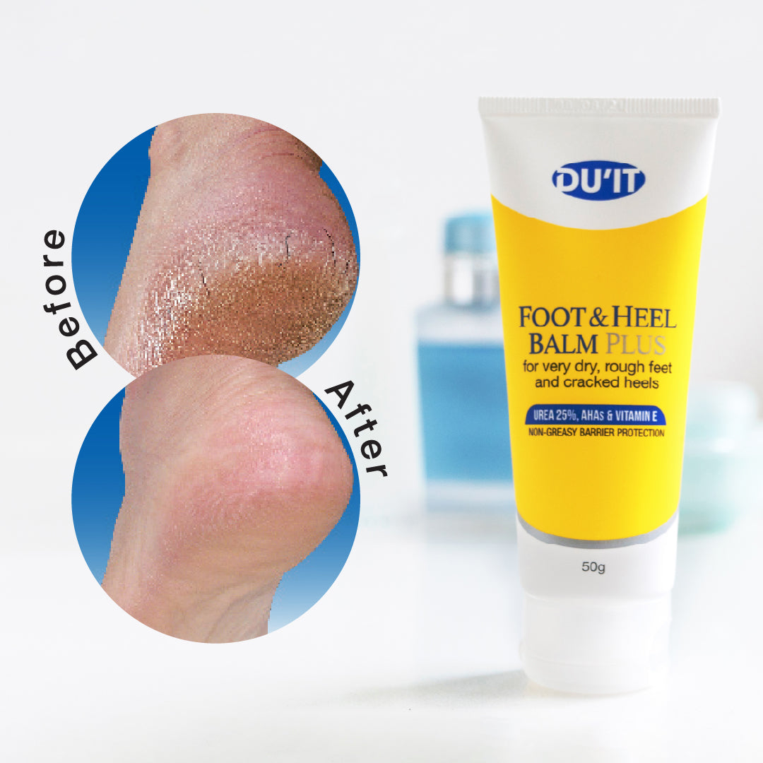 DU’IT Foot & Heel Balm Plus 50g