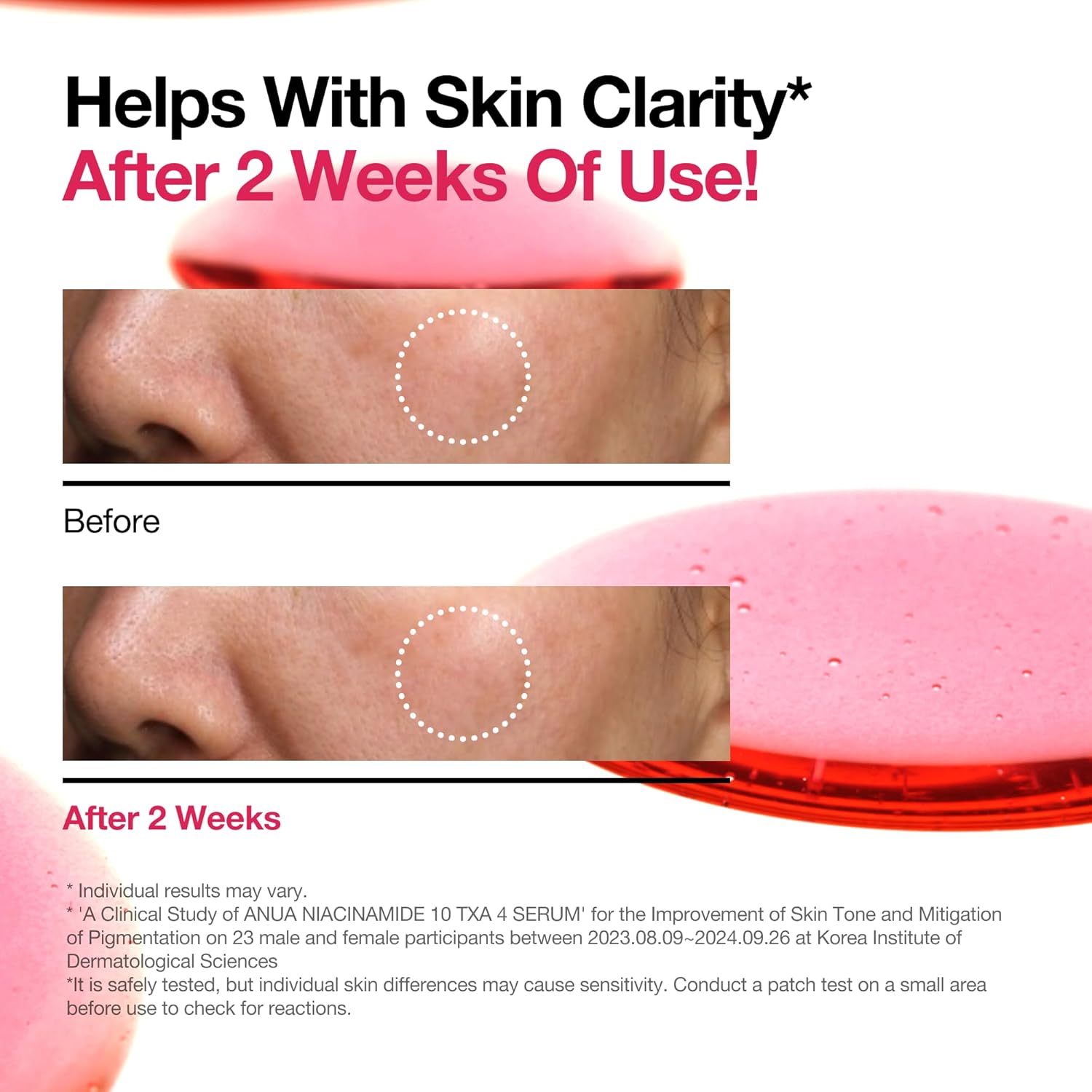 Anua Niacinamide 10 TXA 4 Serum